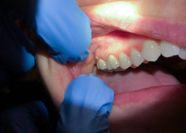 Best Mobile Emergency Dentist in Enid, OK